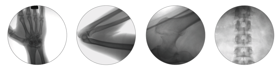 outer dimensions