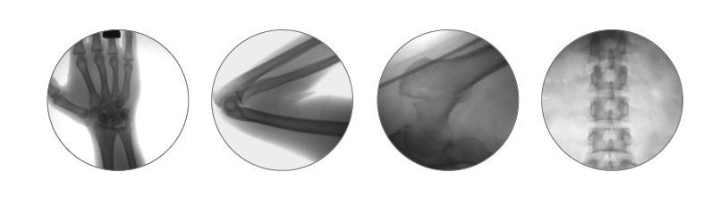 outer dimensions